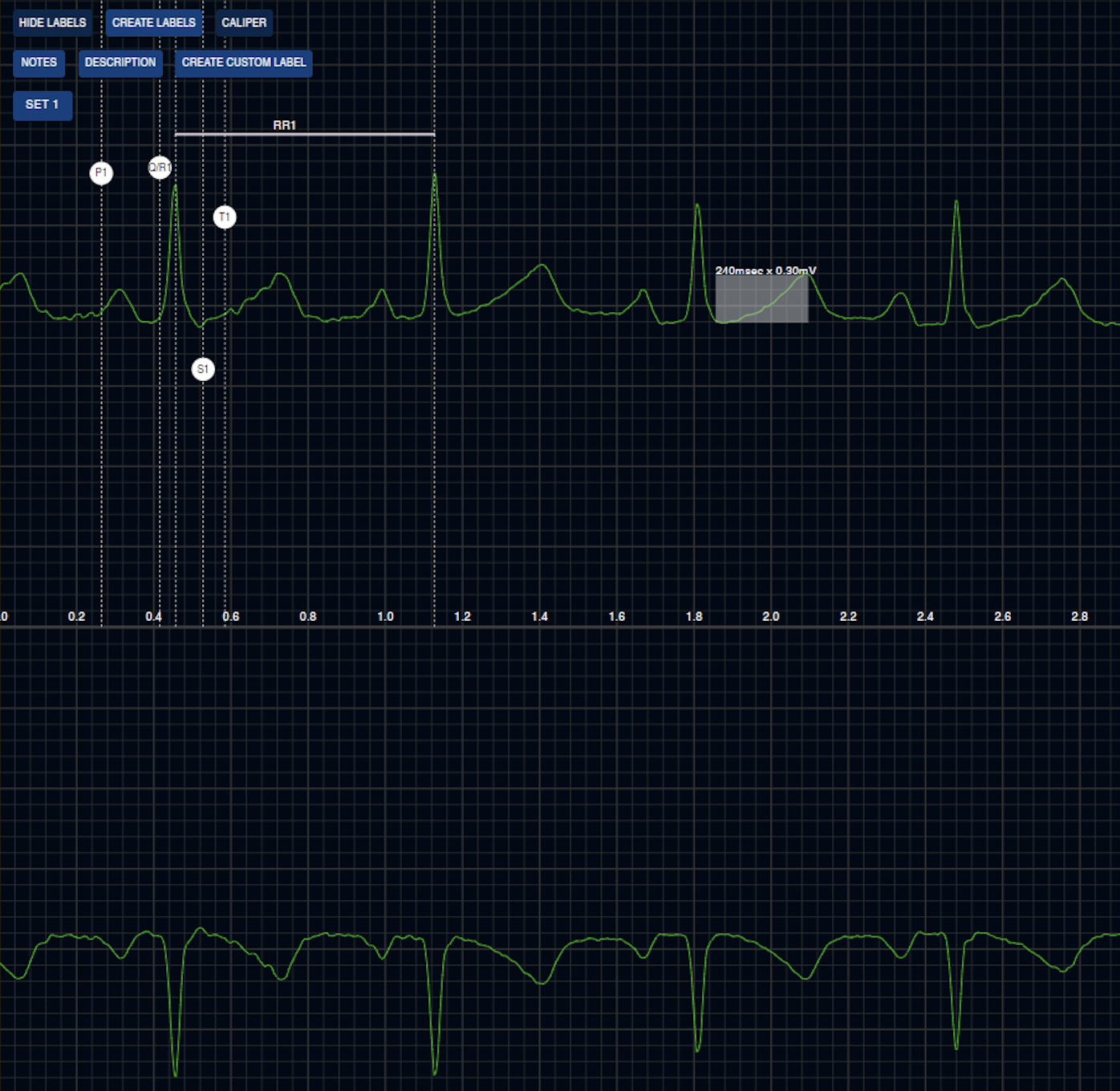 Digital Rhythm Stripping